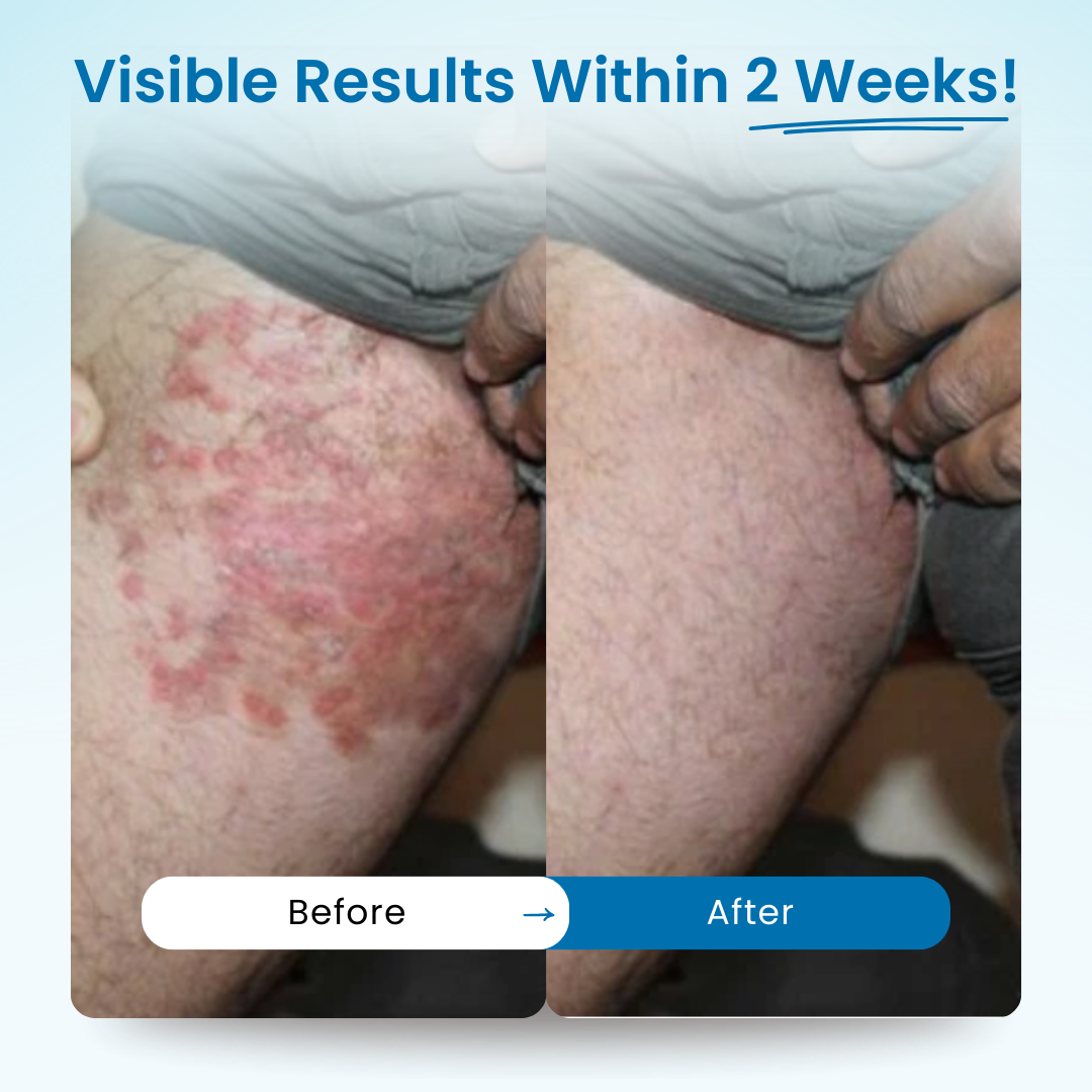 Gentry™ - Men's GentX Relief Cream