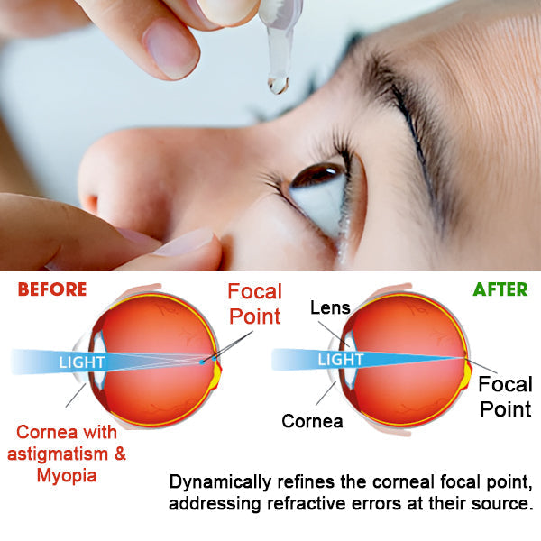 š„ 2025 Limited 70% OFF ļøā³  Kolirin Eye Care Drops