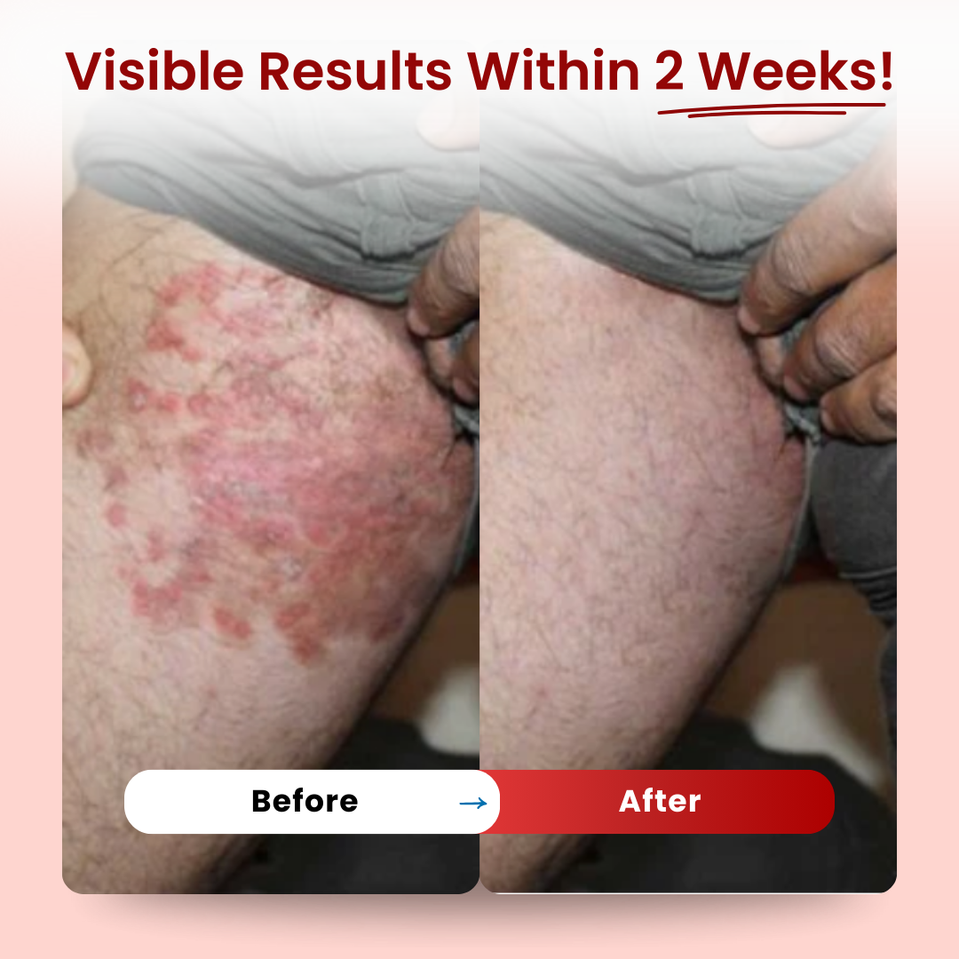 Gentry™ - Men's GentX Relief Cream